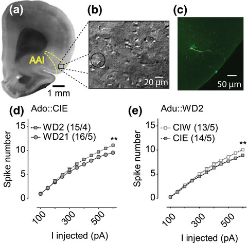 Differential alterations of insular cortex excitability after adolescent or adult chronic intermittent ethanol administration in male rats