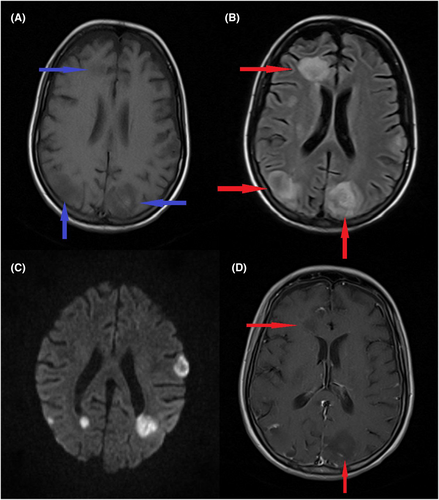 Details are in the caption following the image Details are in the caption following the image