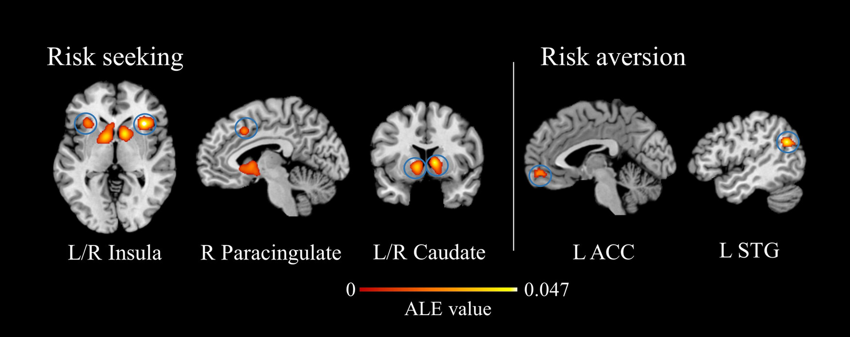 Common and Distinct Neural Mechanisms Underlying Risk Seeking and Risk Aversion: Evidence From the Neuroimaging Meta-Analysis