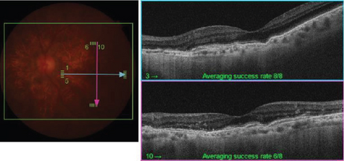 Details are in the caption following the image Details are in the caption following the image