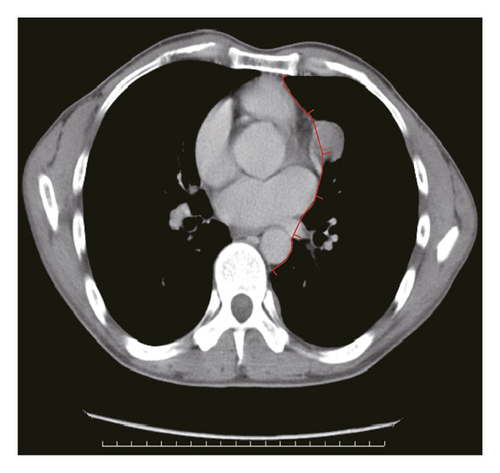 Details are in the caption following the image Details are in the caption following the image