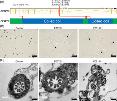 Biallelic mutations of CFAP58 are associated with multiple morphological abnormalities of the sperm flagella