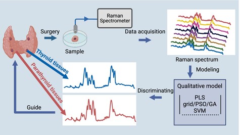 Raman spectroscopy with an improved support vector machine for discrimination of thyroid and parathyroid tissues