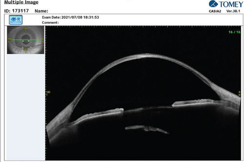 Details are in the caption following the image