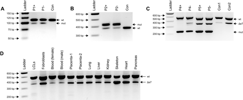 Details are in the caption following the image Details are in the caption following the image
