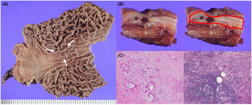 Details are in the caption following the image Details are in the caption following the image