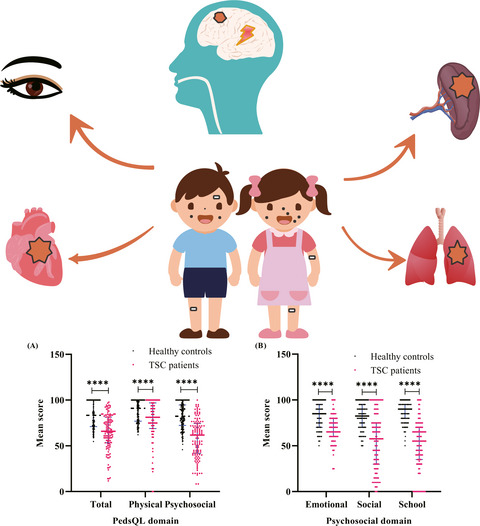 Quality of life in children with tuberous sclerosis complex: A pediatric cohort study