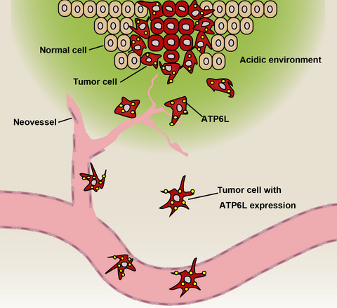 ATP6L promotes metastasis of colorectal cancer by inducing epithelial-mesenchymal transition