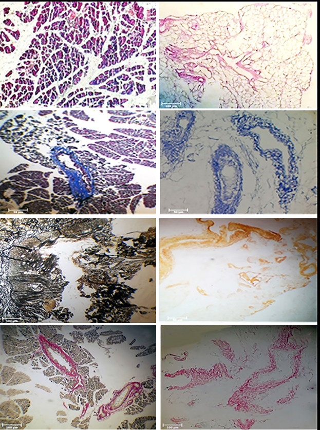 Application of a novel bioreactor for in vivo engineering of pancreas tissue