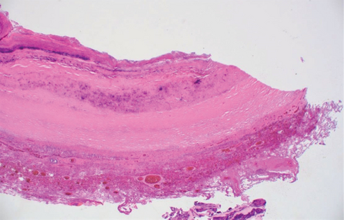 Details are in the caption following the image