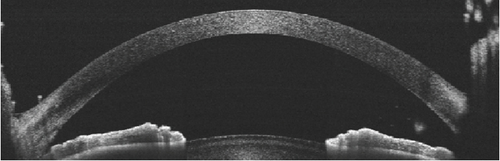 Details are in the caption following the image