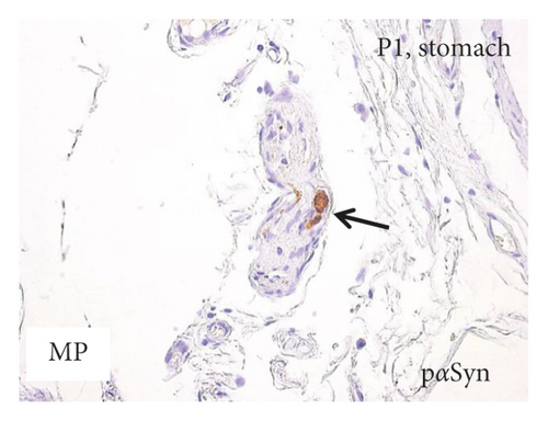 Details are in the caption following the image