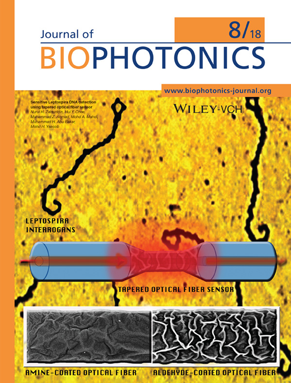 Inside Back Cover: Sensitive Leptospira DNA detection using tapered optical fiber sensor (J. Biophotonics 8/2018)