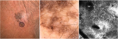 Details are in the caption following the image Details are in the caption following the image