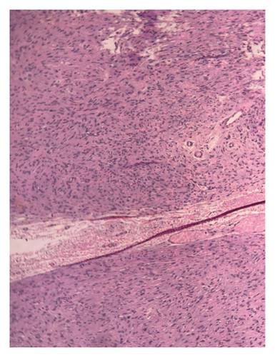 Details are in the caption following the image