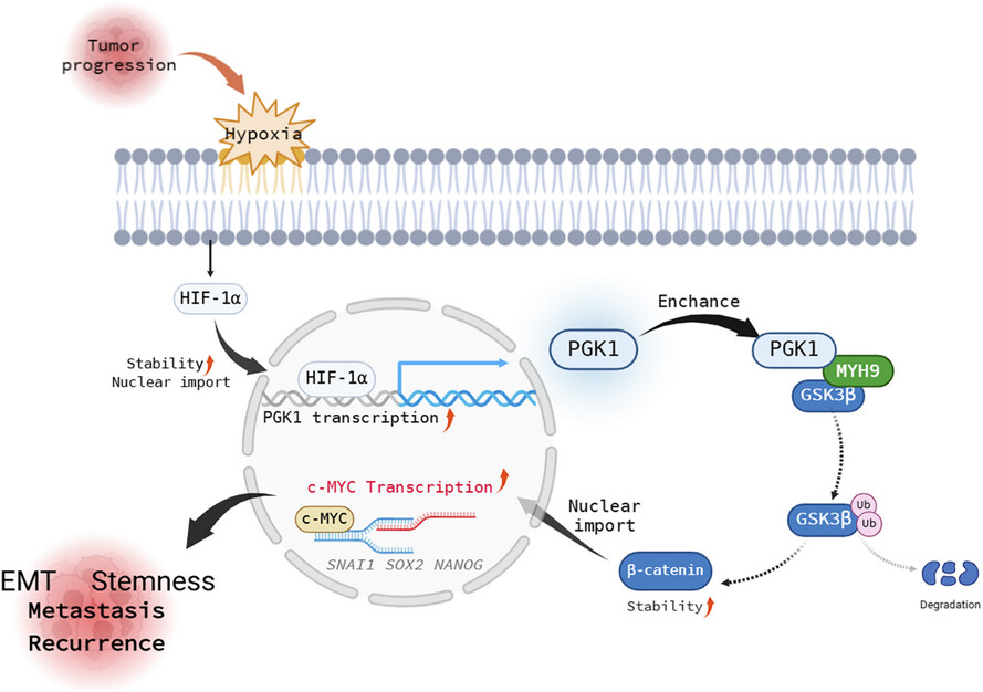 Hypoxia-induced PGK1 expression promotes esophageal squamous cell carcinoma progression via stimulating MYH9-mediated GSK3β/β-catenin signalling