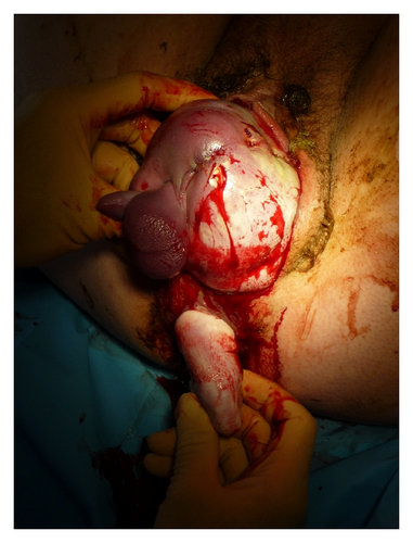 Details are in the caption following the image Details are in the caption following the image