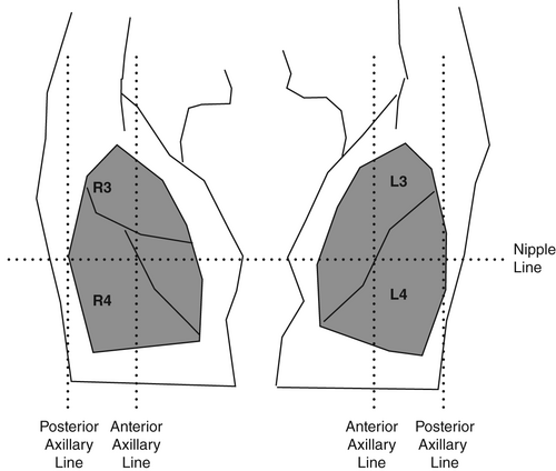 Details are in the caption following the image