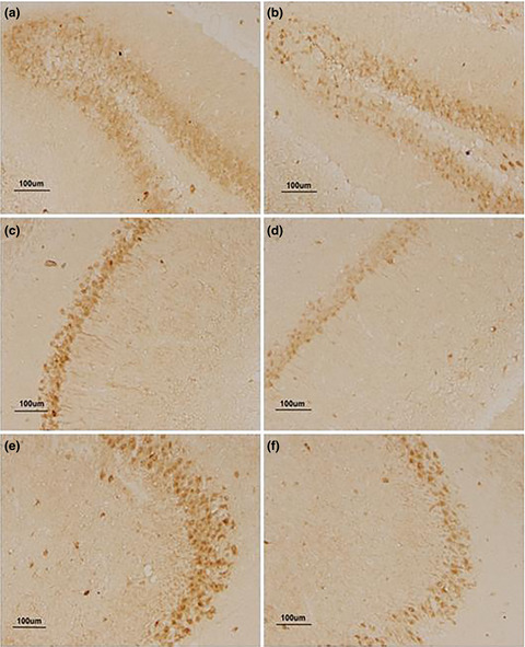 Lipopolysaccharide exposure during late embryogenesis triggers and drives Alzheimer-like behavioral and neuropathological changes in CD-1 mice