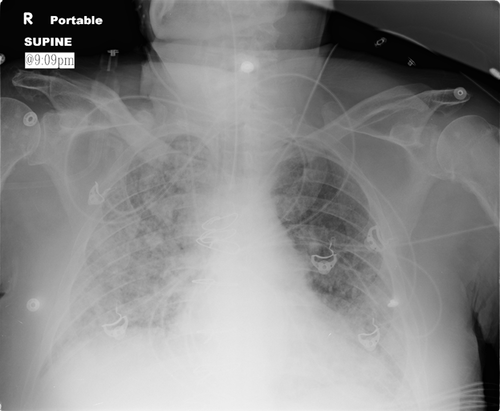 Details are in the caption following the image