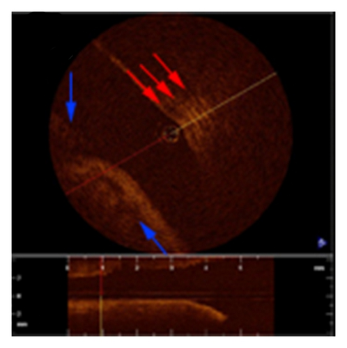 Details are in the caption following the image Details are in the caption following the image