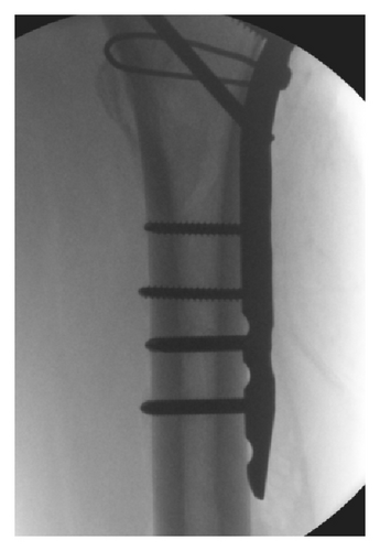 Details are in the caption following the image Details are in the caption following the image