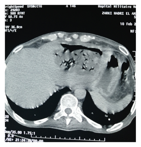Details are in the caption following the image Details are in the caption following the image