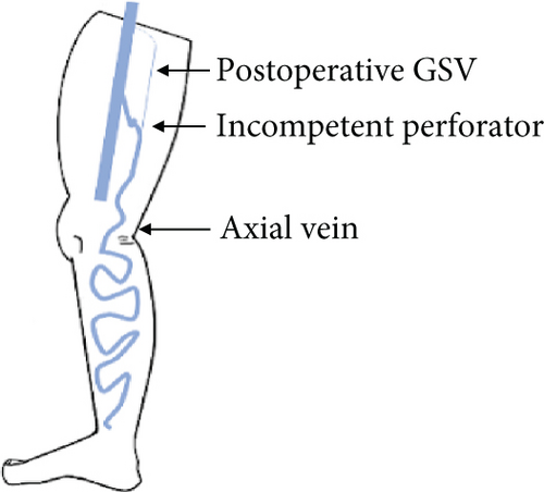 Details are in the caption following the image
