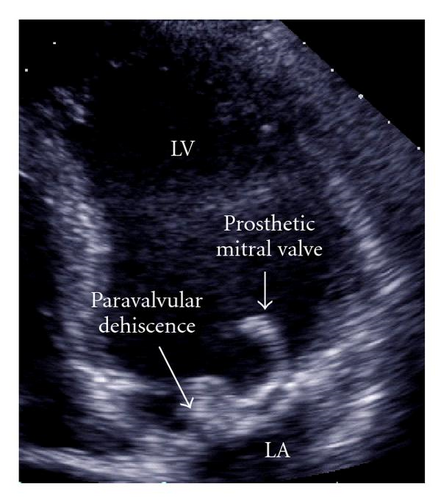 Details are in the caption following the image