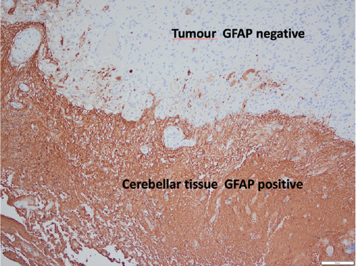 Details are in the caption following the image