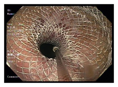 Details are in the caption following the image