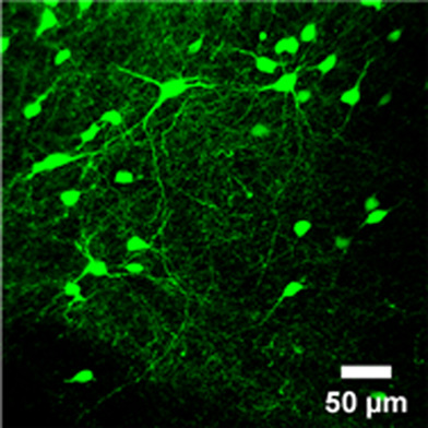 UnaG as a reporter in adeno-associated virus-mediated gene transfer for biomedical imaging
