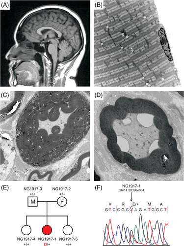Details are in the caption following the image