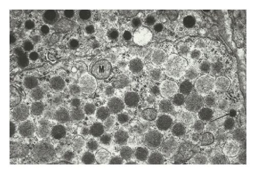 Details are in the caption following the image