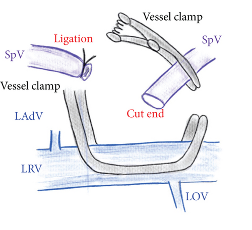 Details are in the caption following the image