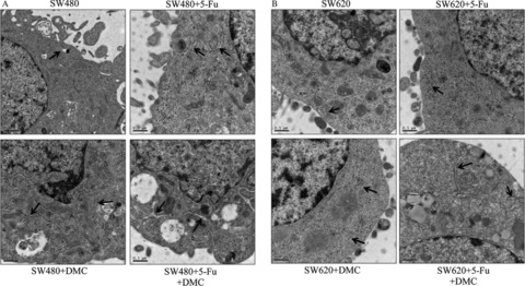 In vitro additive antitumor effects of dimethoxycurcumin and 5-fluorouracil in colon cancer cells
