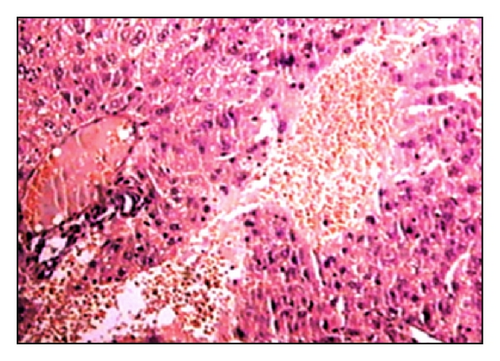 Details are in the caption following the image