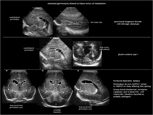 Details are in the caption following the image Details are in the caption following the image