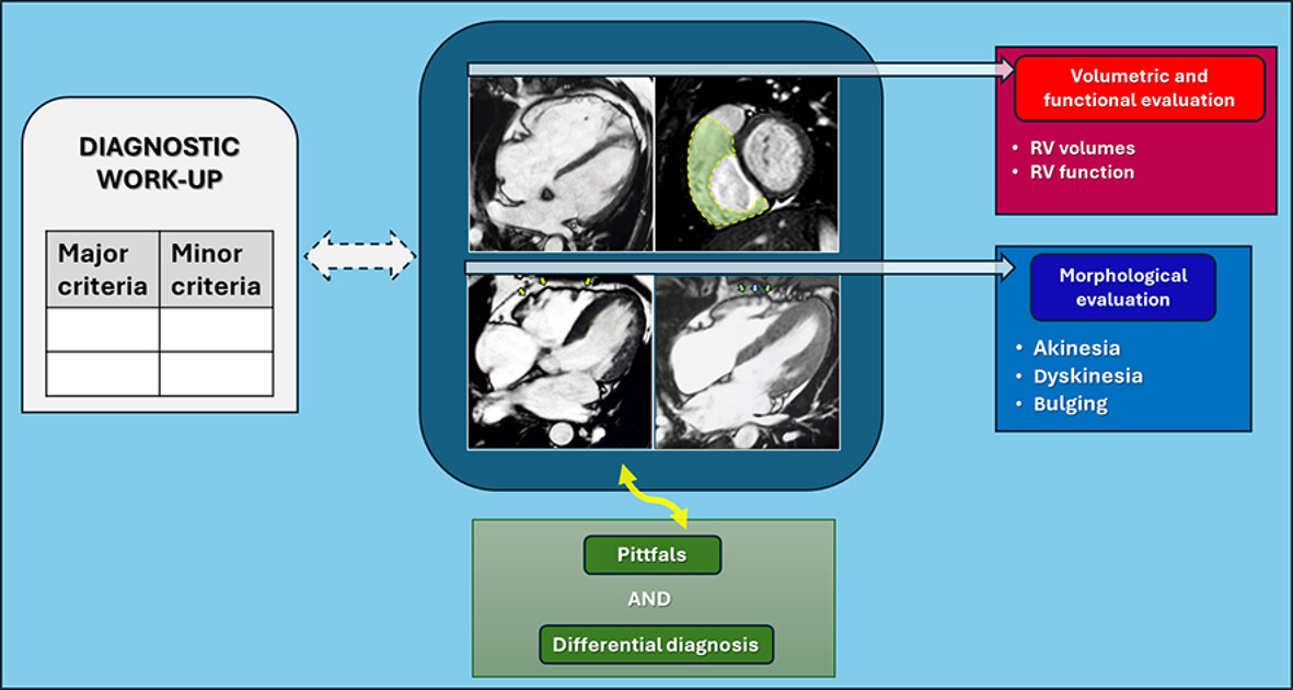 Before and Beyond Tissue Characterization: Cardiac Magnetic Resonance Imaging in the Morphological, Volumetric, and Functional Evaluation of the Right Ventricle in Arrhythmogenic Right Ventricular Cardiomyopathy, a Narrative Review