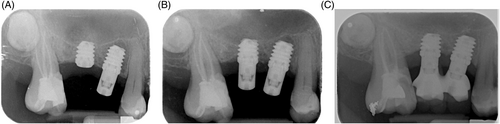 Details are in the caption following the image Details are in the caption following the image