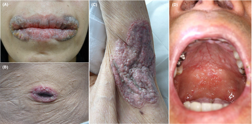 Details are in the caption following the image Details are in the caption following the image