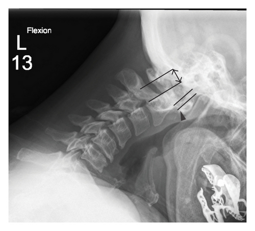Details are in the caption following the image Details are in the caption following the image