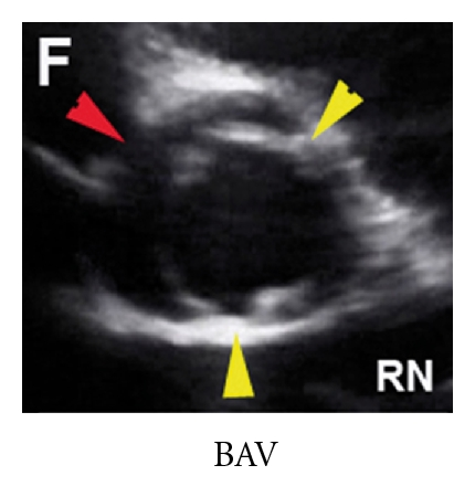 Details are in the caption following the image