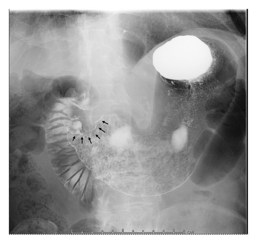Details are in the caption following the image Details are in the caption following the image