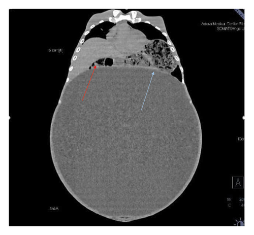 Details are in the caption following the image Details are in the caption following the image