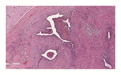Details are in the caption following the image