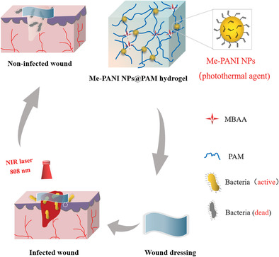 A Polyaniline Nanoparticles Crosslinked Hydrogel with Excellent Photothermal Antibacterial and Mechanical Properties for Wound Dressing