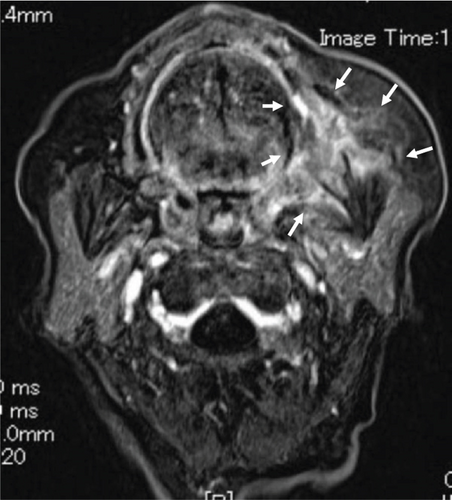 Details are in the caption following the image