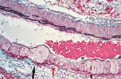 Details are in the caption following the image