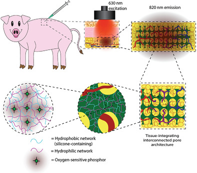 Inorganic–Organic Interpenetrating Network Hydrogels as Tissue-Integrating Luminescent Implants: Physicochemical Characterization and Preclinical Evaluation